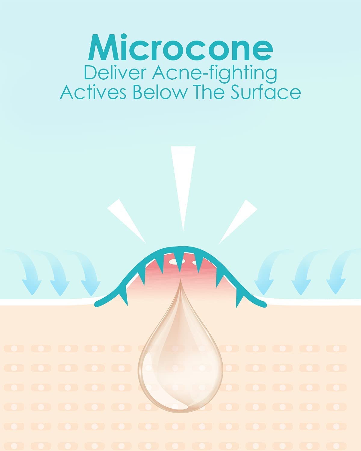 Microdart Acne Patch (54 Patches) - Hyaluronate Acid & Salicylic Acid Hydrocolloid Pimple Patch for Deep, Early and Hidden Blemishes (54 Count (Pack of 1))