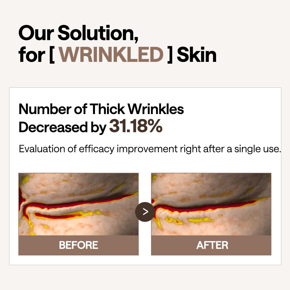 Mediheal Retinol Collagen Under Eye Patches - Korean Hydrogel Eye Pads (60 patches) with 95% Retinol & 5 Micro Collagen. Nourishing & Non Irritating Eye Gel Mask. Sealing Cap & Spatula Included.