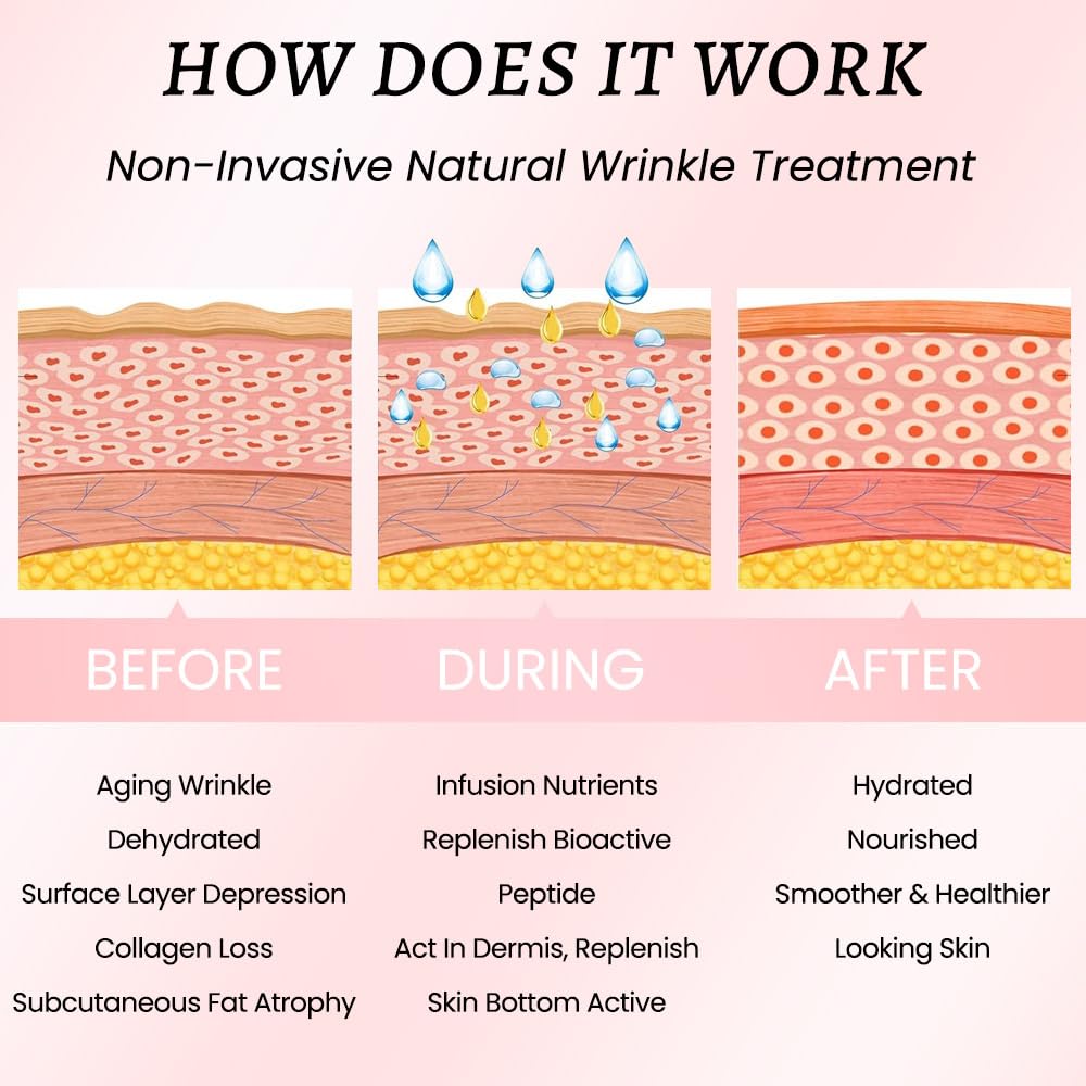 Kaely 256 Pcs Wrinkle Patches for Face Overnight, Silicone Scar Tape for Wrinkles Forehead, Face Tape for Wrinkles Overnight Sleeping Lifting Sagging Skin, Smile Line Facial Smoothing