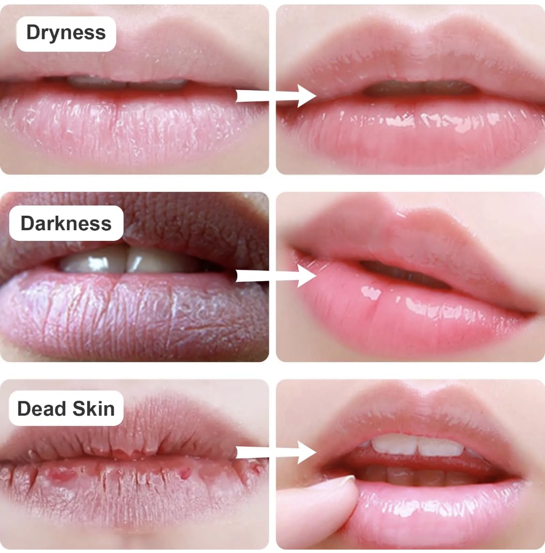 New Lip and Eye Mask 2 Sets, Hydro-Gel Eye Mask For Puffiness, Lip Collagen Plumper, Eye Mask Skincare, Rich Goat Milk, Lot Of 4 (black/gold)