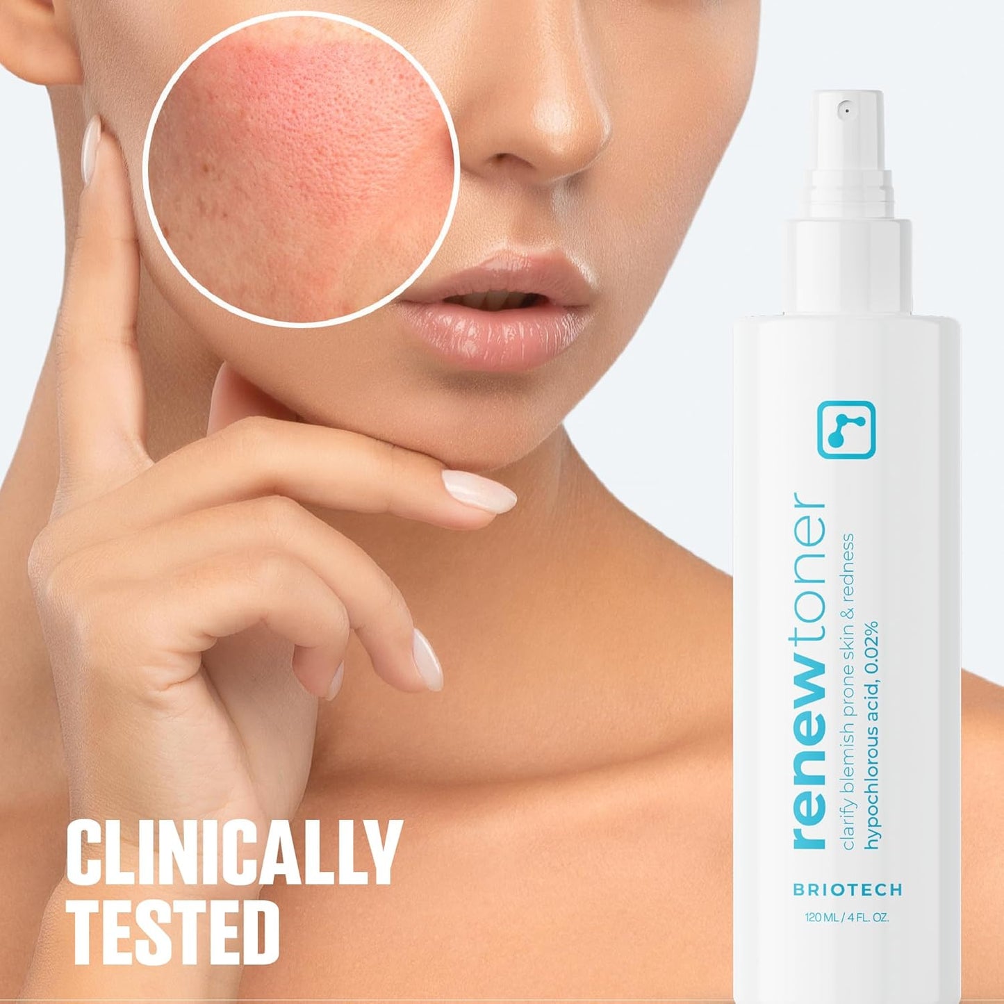 BRIOTECH Renew Toner, Hypochlorous Acid Spray, Minimize Appearance of Blemishes, Soothing Facial Mist for Sensitive Skin, Calm Redness & Bumps, Vegan, 2 fl oz Travel Size (2 Pack)