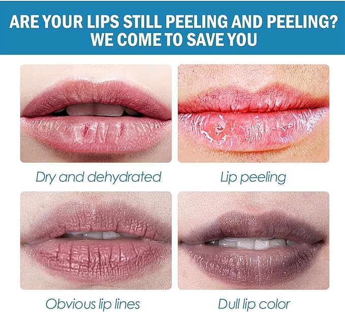 2PC Lip Balm Fade Dark Pigment Whitening Moisturizing Lip Hyaluronic Acid Exfoliating Dead Skin Lightening Lip Care (Green)