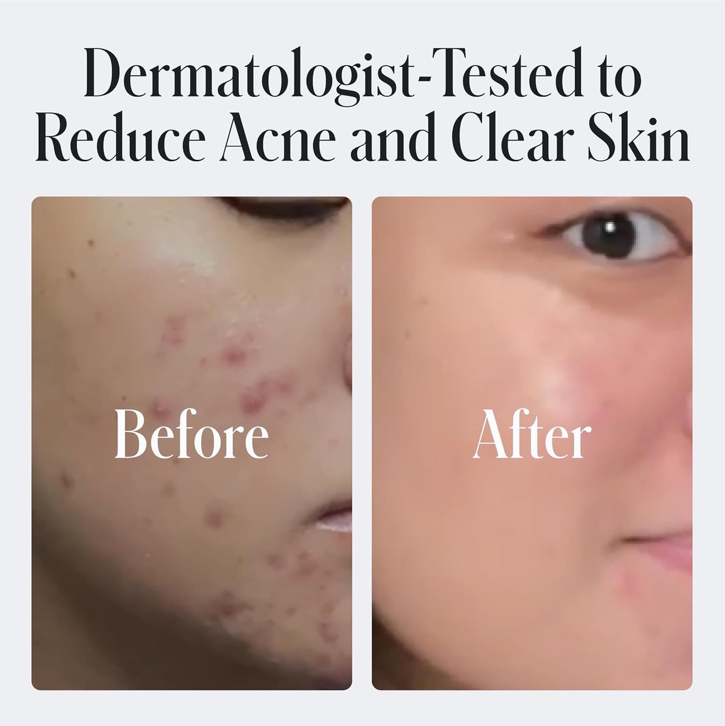 Geologie 2% Salicylic Acid Face Wash Bergamot + Juniper Scent | Facial Cleanser for Men & Women | Acne & Oil Control | Deep Cleansing & BHA Exfoliating Face Wash | 2-Pack