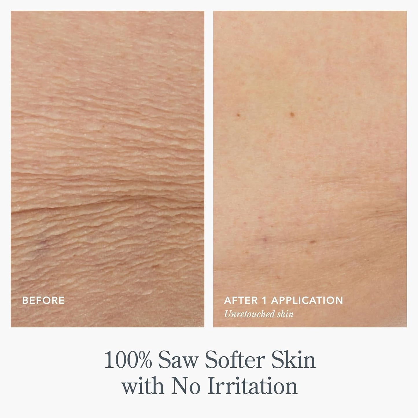 Beekman 1802 Whipped Body Butter Cream with Goat Milk - Deeply Moisturizes, Softens Skin - Natural & Gentle for All Skin Types - Non-Greasy, Cruelty-Free, 8 oz