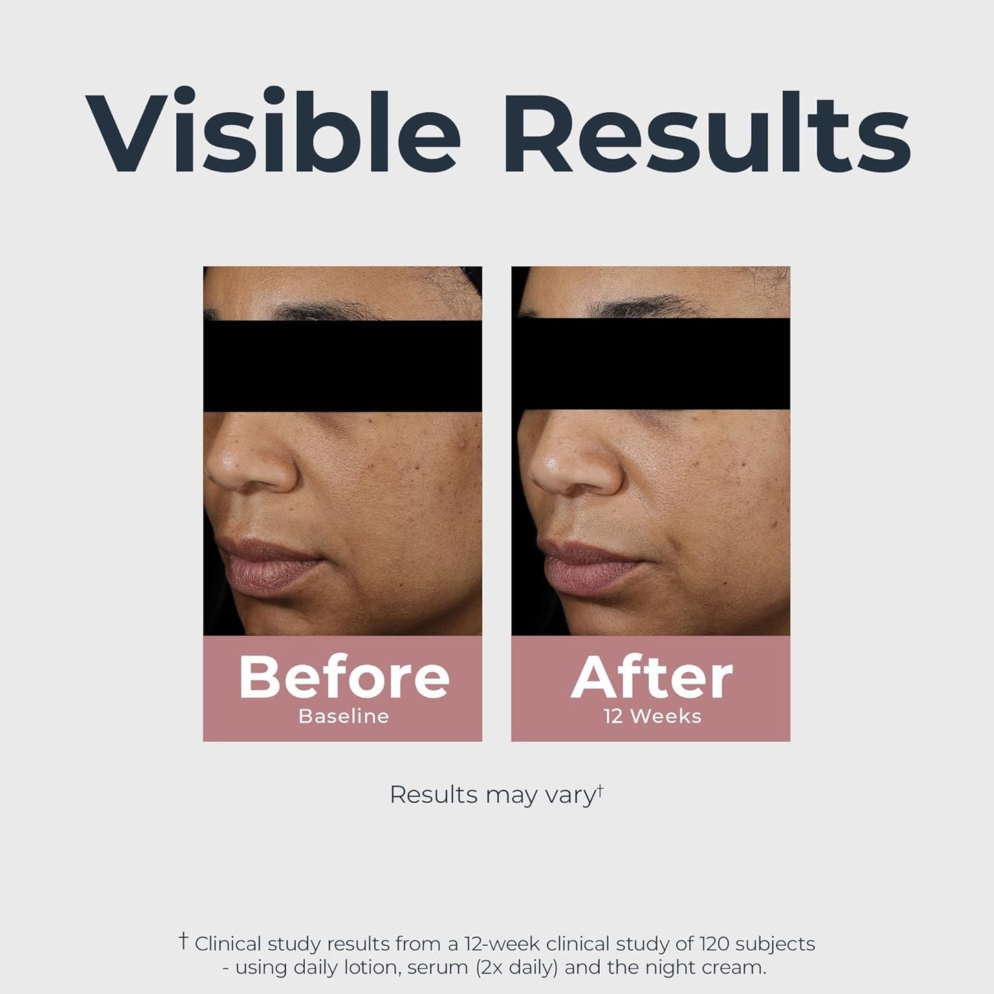 Eucerin Radiant Tone Daily Face Lotion with SPF 30, Dark Spot Corrector with Thiamidol, Face Moisturizer Helps Visibly Reduce the Look of Persistent Dark Spots, All Skin Types, 1.7 Fl Oz Bottle