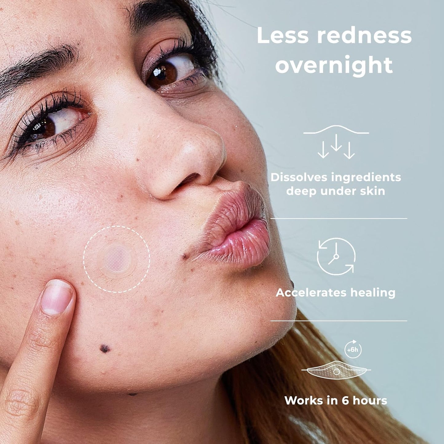 OMMA Korean Microdart Acne Patch, Cystic Acne Treatment, Micropoint Pimple Patches for Face for Early-Stage Painful Zits, Salicylic Acid & Tea Tree - 14 mm Zit Stickers (18 Count)