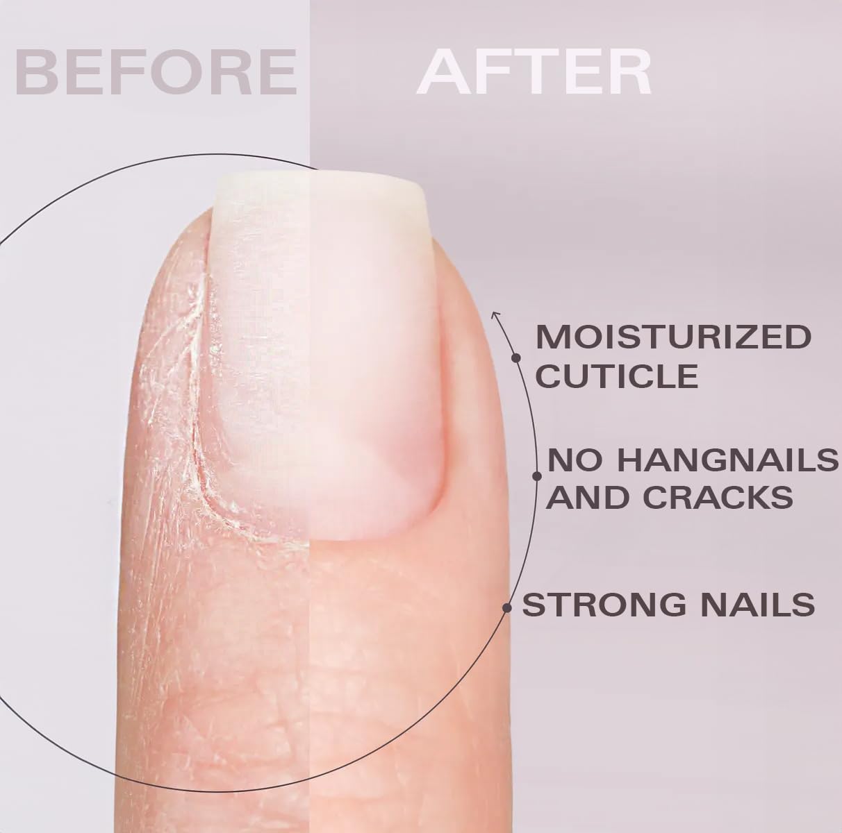 Cuticle Oil Pen Vacation Mood Set of 3 - Pineapple, Peach, Watermelon Scents