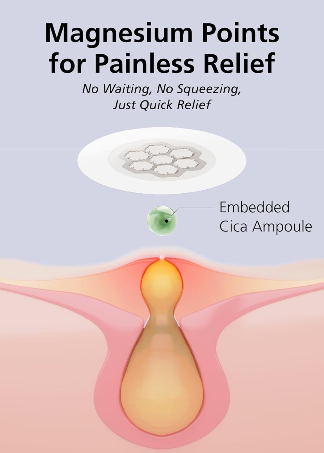 Quick Calming Magnesium Patches(20 patches) with Cica Ampoule - Intensive Care, Pimple patches, Hydrocolloid Band, Zits Spot care Overnight Home Care 2-8 hours, New boxs types