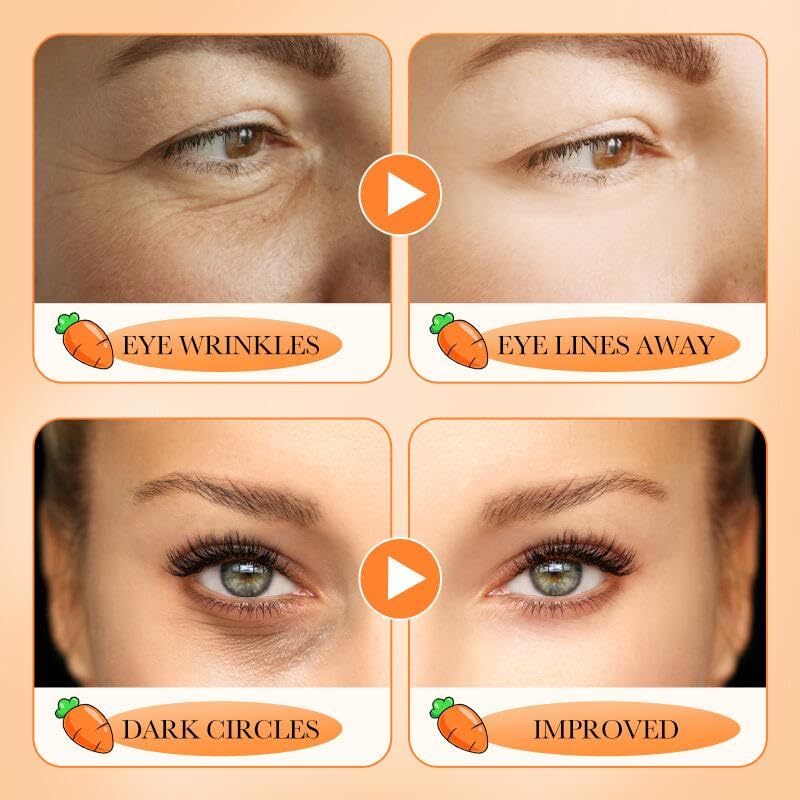 Carotene Eye Cream Moisturizes, Carrot Vita Eye Cream, Eye Wrinkles and Eye Bags, Tighten and Firm Eye Skin, Hydrating, Moisturizes Reduces Puffiness