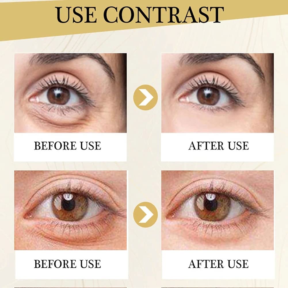 Lift Firming Eye Cream, Polypeptide Anti-Aging Eye Cream for Removing Wrinkie Dark Circles Eye Bags Nourishing Under Eye Eyelid Serum Skin Care