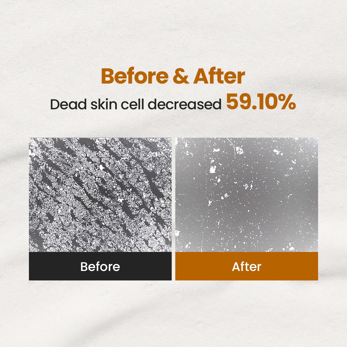 Enzyme Cleansing Powder – 15g (0.53 oz) – Purifies Pores, Removes Blackheads & Whiteheads, With Papain Enzyme for Smooth & Clear Skin | Low pH, Non-Irritating, For Sensitive Skin