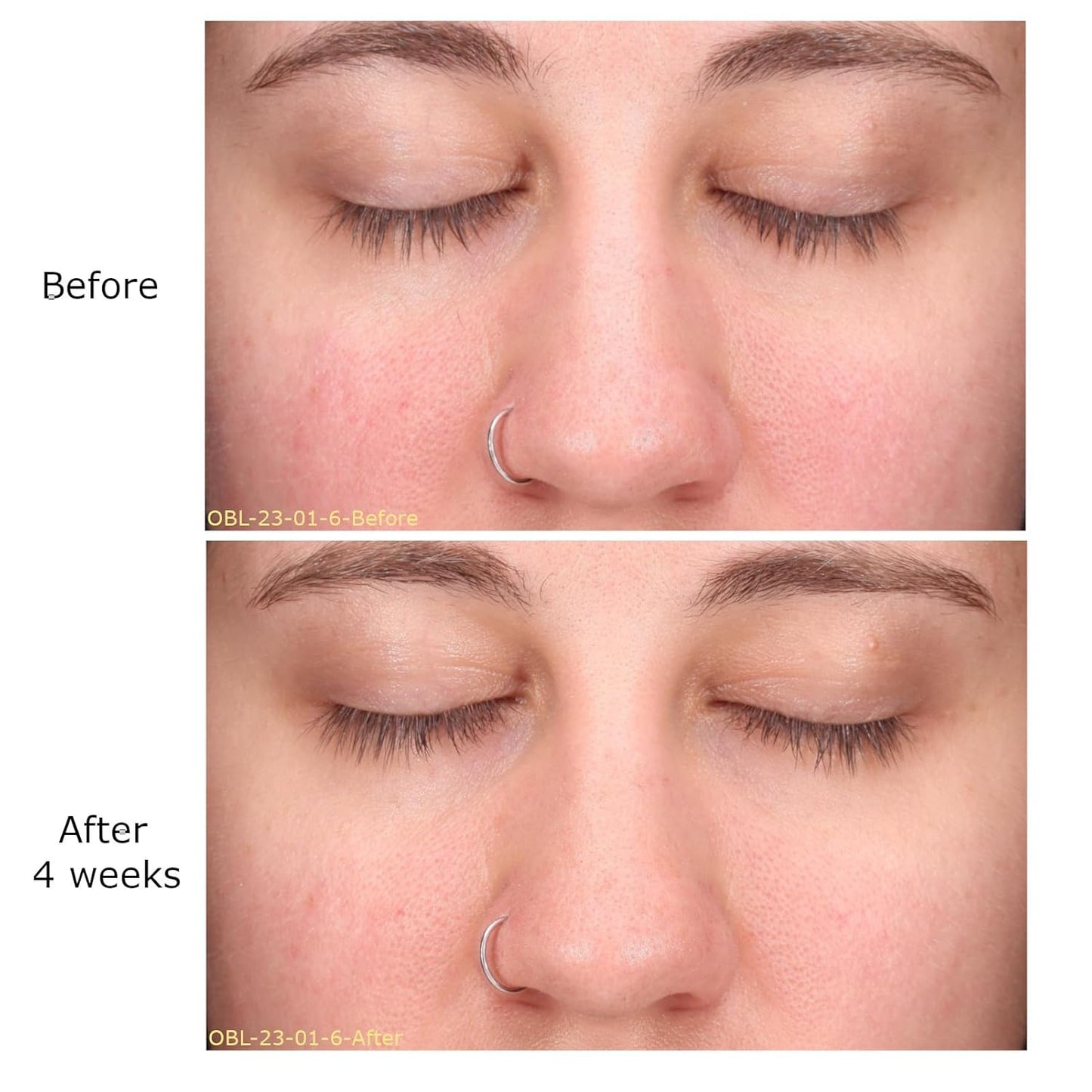 Daily Moisturizing Collection, Activator with Clarifying Azelaic Acid+ Concentrate Starter, Brightening, Firming Clarity, Suitable for Sensitive Skin, Gift Bundle/Starter Kit