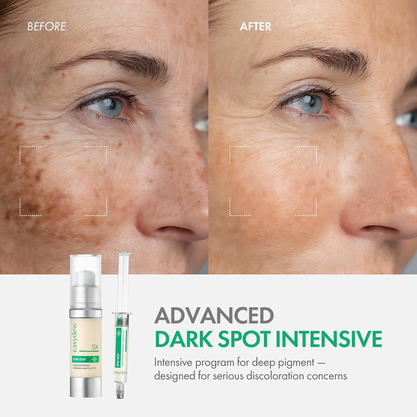 Easydew DW-EGF Melatoning Ampoule 5X - Hydrating Dark Spot Serum with Niacinamide & Glutathione for Uneven Skin - Fast Absorbing Day & Night Ampoule Korean Skin Care (Bottle 1.01 fl oz, EGF 5X)