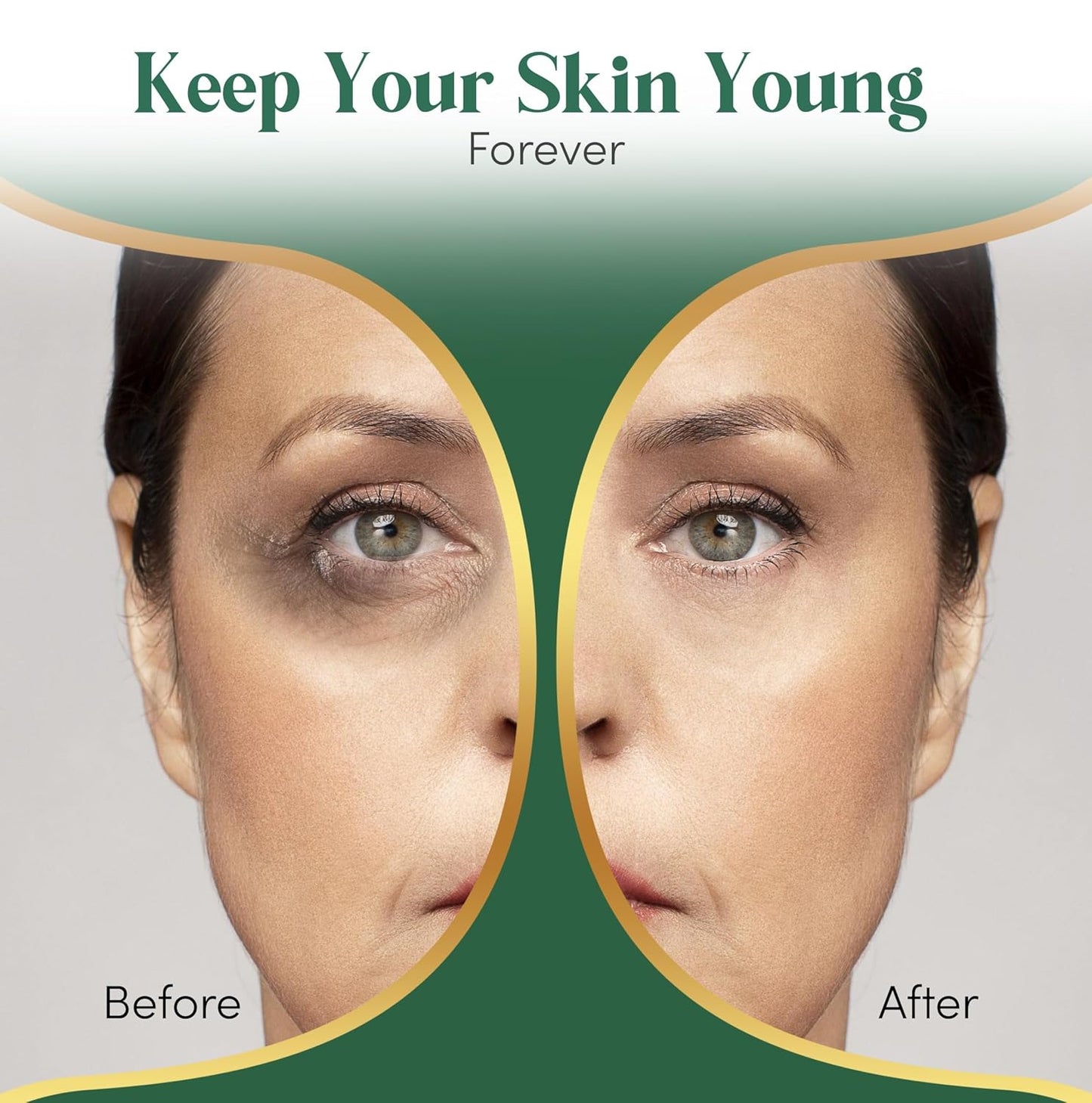 24K Gold Under Eye Patches For Puffy Eyes (12 Pairs Individually Wrapped) - Collagen Enriched Under Eye Masks for Dark Circles and Puffiness, Hyaluronic Acid Under Eye Mask Patches for Wrinkles